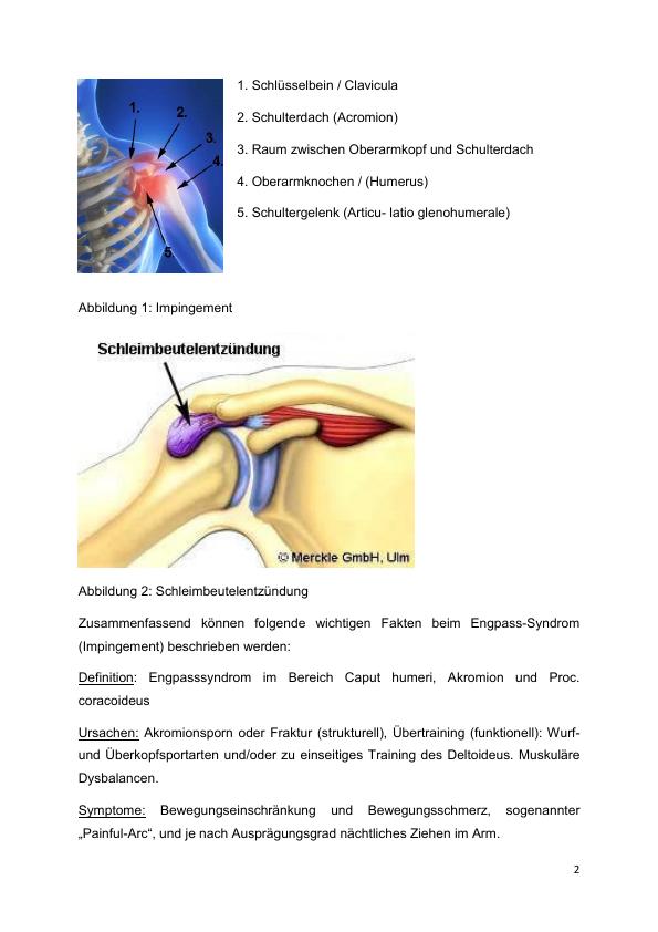 Sportrehabilitation Beim Impingement-Syndrom Der Schulter - GRIN | Grin