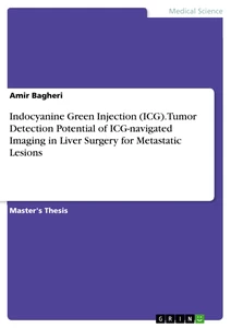 Indocyanine Green Injection (ICG). Tumor Detection Potential of ICG-navigated Imaging in Liver Surgery for Metastatic Lesions