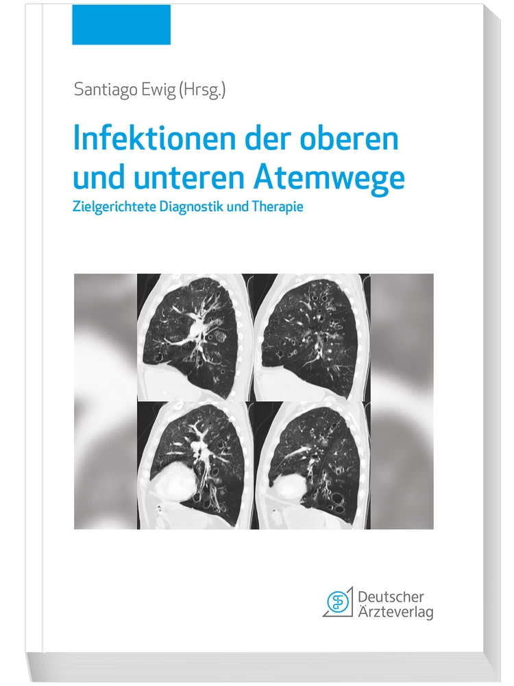 Titel: Infektionen der oberen und unteren Atemwege