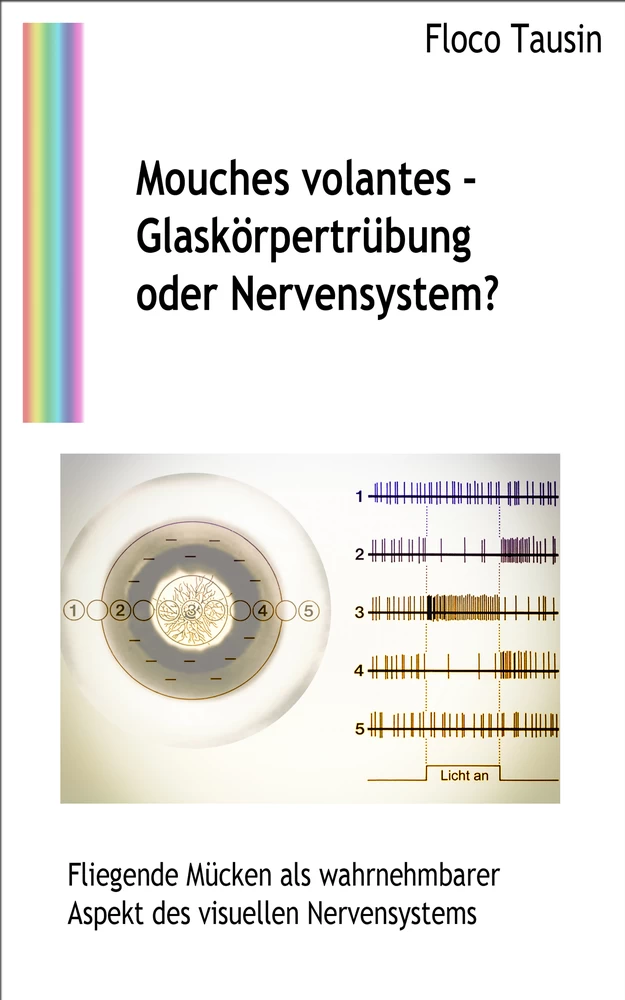 Titel: Mouches volantes - Glaskörpertrübung oder Nervensystem?