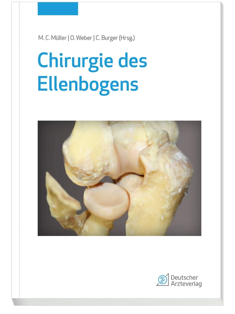 Titel: Chirurgie des Ellenbogens