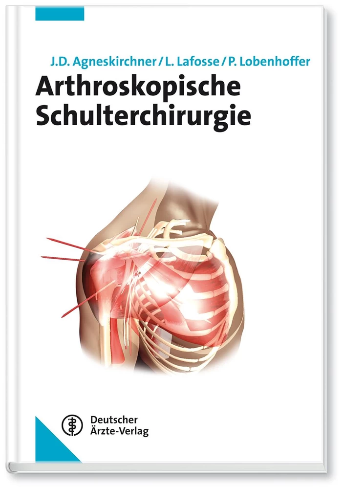 Titel: Arthroskopische Schulterchirurgie