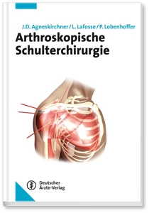 Titel: Arthroskopische Schulterchirurgie